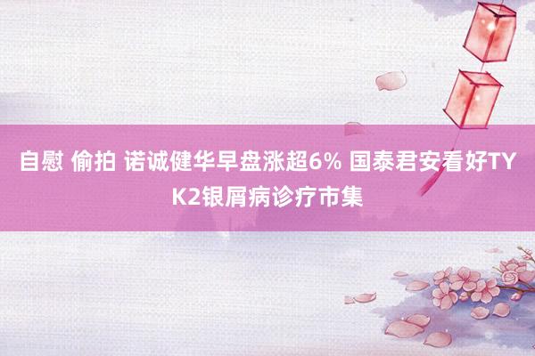 自慰 偷拍 诺诚健华早盘涨超6% 国泰君安看好TYK2银屑病诊疗市集